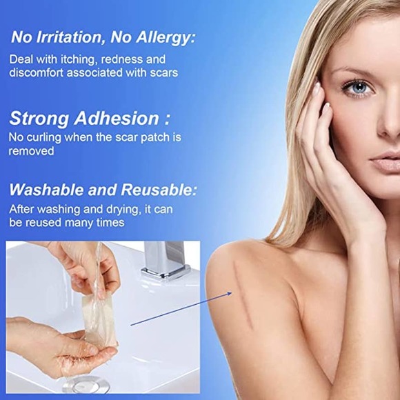 Silicone Scar Sheets (1.6” x 60”Roll-150cm) Scar Tape Reusable, Washable - Picture 2 of 7